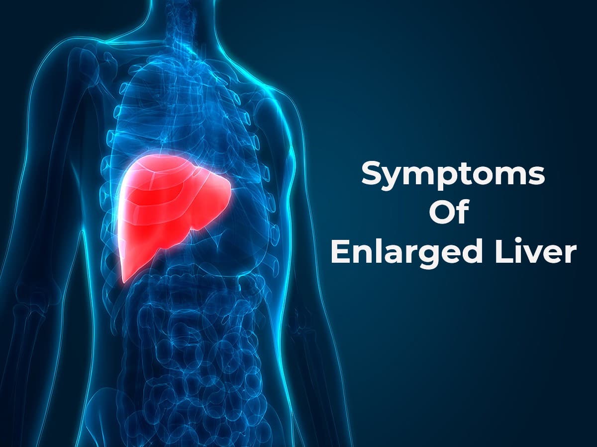 Hepatomegaly: Enlarged Liver Is A Serious Condition You Shouldn't Ignore
